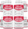 Acnetame Pastillas para el Acné - 240 Comprimidos