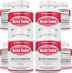 Acnetame Pastillas para el Acné - 240 Comprimidos