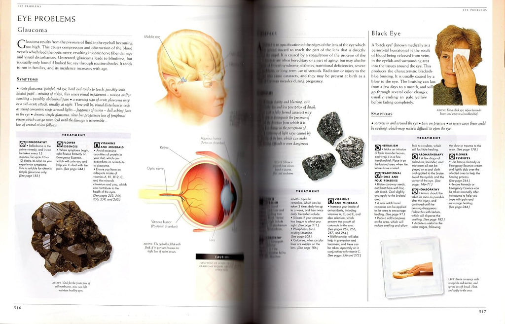 Illustrated Encyclopedia of Healing Remedies