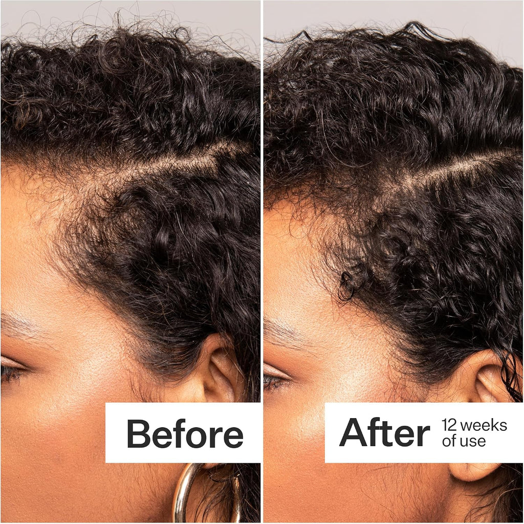 ACT+ ACRE Thick + Full Hair Capsules | Cápsulas para Cabello Más Grueso y Fuerte | Bambú, Cola de Caballo, Biotina, Vitamina C | Fortalece Raíces, Vegano, Sin Gluten, con Esencia de Menta | 60 Cápsulas