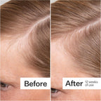 ACT+ ACRE Thick + Full Hair Capsules | Cápsulas para Cabello Más Grueso y Fuerte | Bambú, Cola de Caballo, Biotina, Vitamina C | Fortalece Raíces, Vegano, Sin Gluten, con Esencia de Menta | 60 Cápsulas