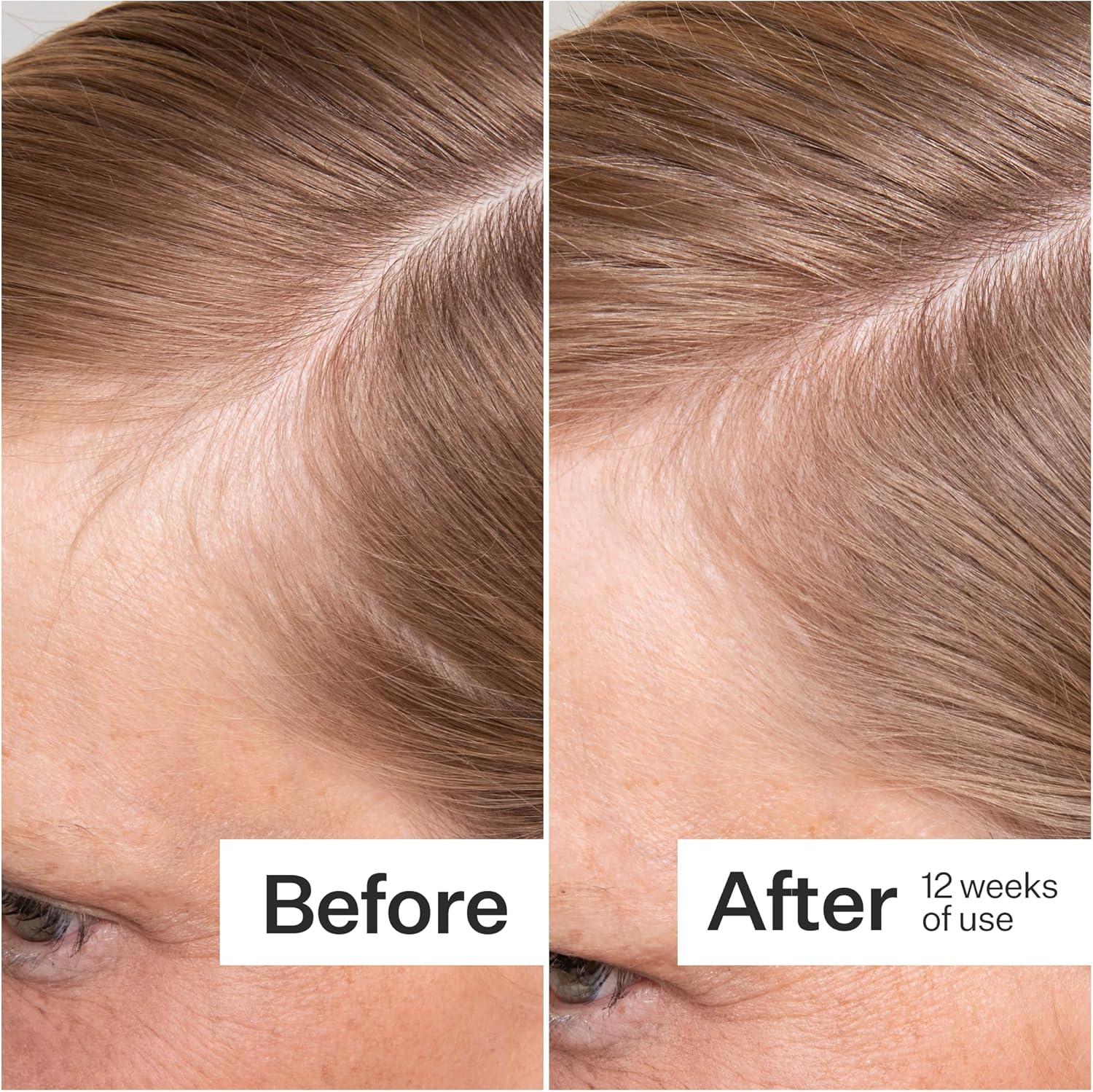 ACT+ ACRE Thick + Full Hair Capsules | Cápsulas para Cabello Más Grueso y Fuerte | Bambú, Cola de Caballo, Biotina, Vitamina C | Fortalece Raíces, Vegano, Sin Gluten, con Esencia de Menta | 60 Cápsulas